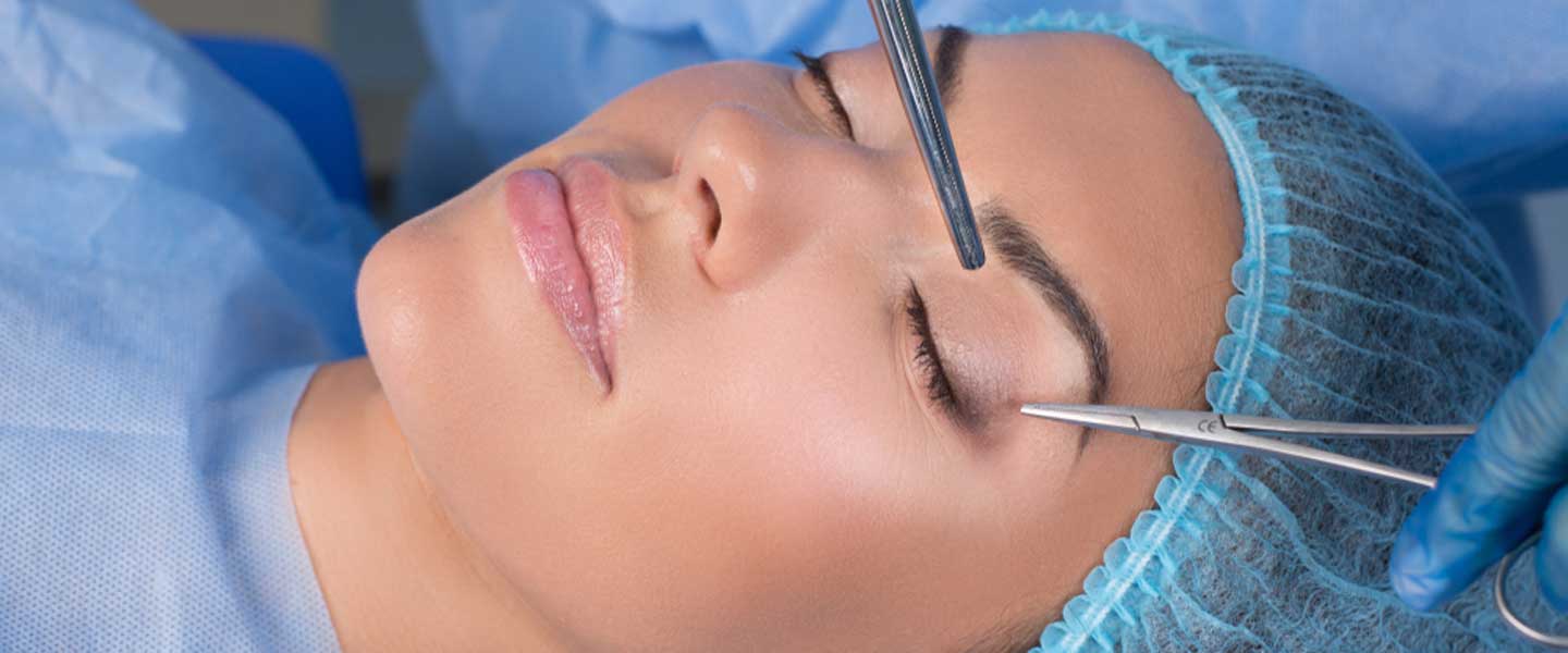 ¿Qué es la Estética de Párpados (Blefaroplastia)?