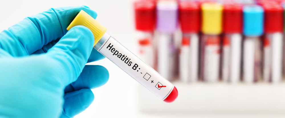 ¿Qué es la hepatitis B? ¿Cuáles son los síntomas y métodos de tratamiento?